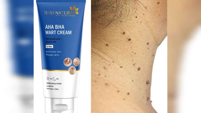 7DaysNatural Wart Cream – Trusted Natural Solution for Wart Removal Without Surgery 7DaysNatural Wart Cream – Trusted Natural Solution for Wart Removal Without Surgery